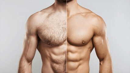 Hair removal two